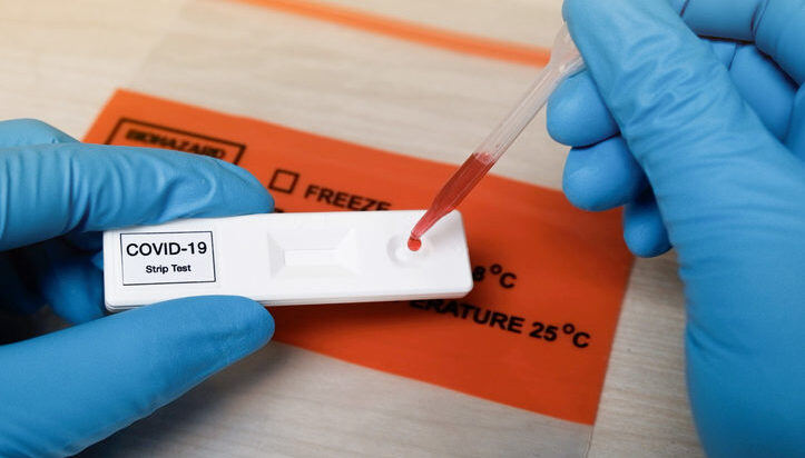 Sigue la disputa por los test rápidos: "No se puede prohibir el acceso democrático"