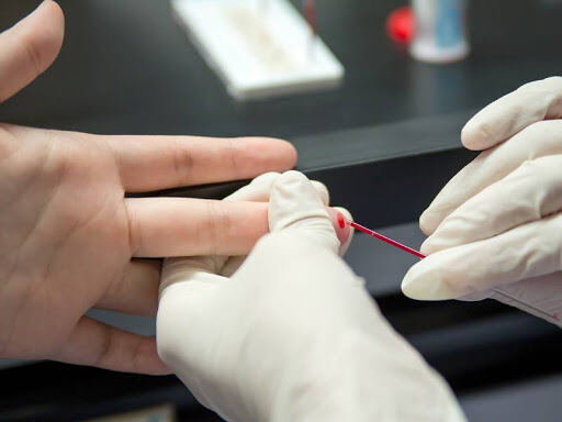 Berisso: Llevan adelante una campaña de Test rápido de ETS en Centros de Salud